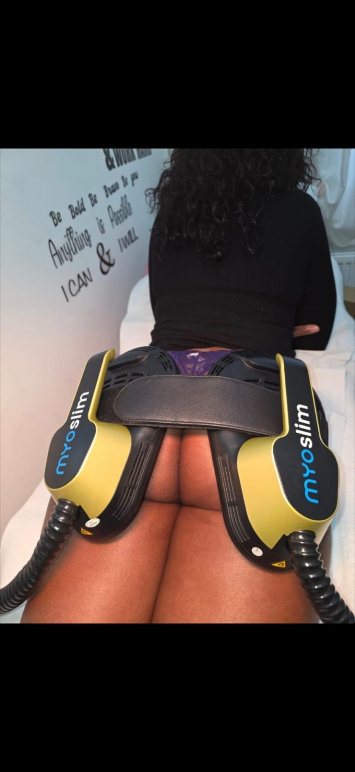 EMS body sculpting treatment image