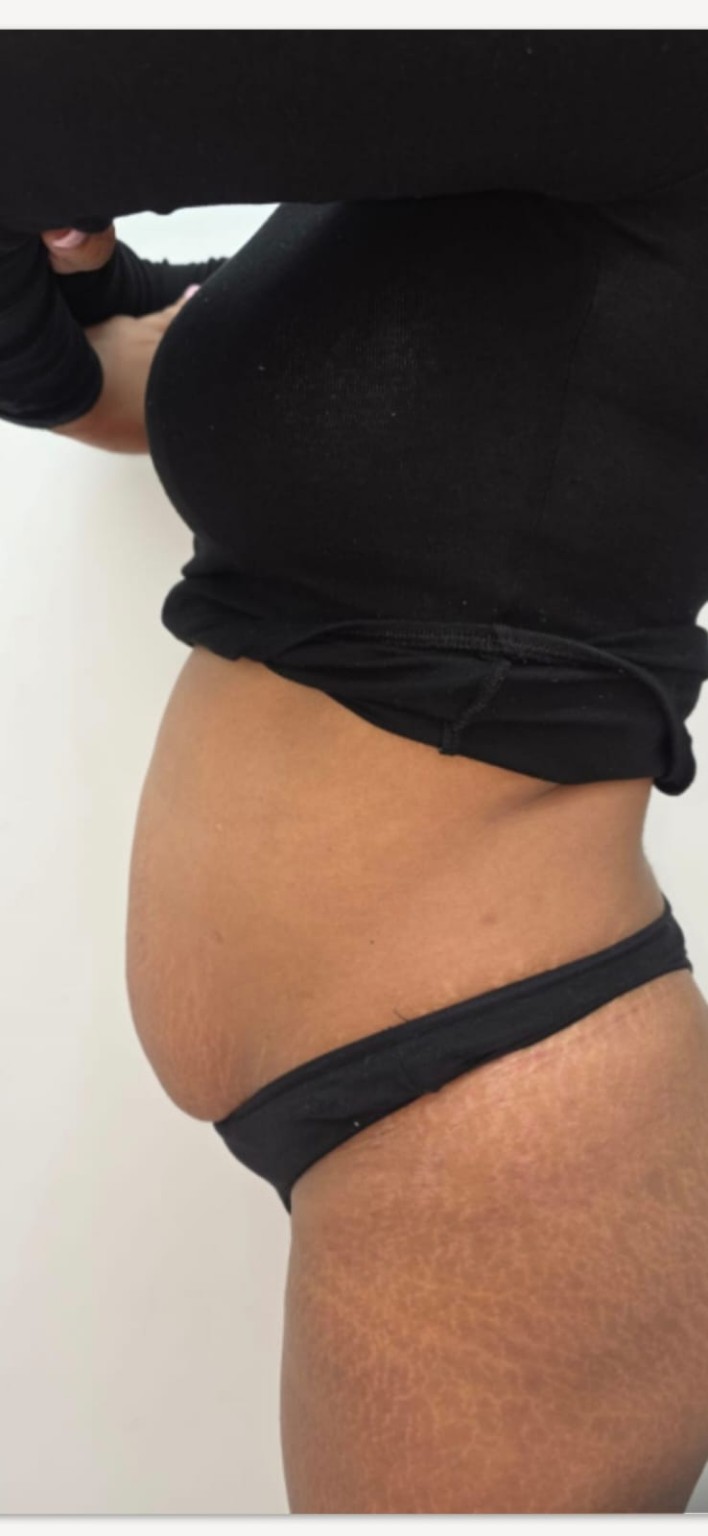 EMS body treatment image