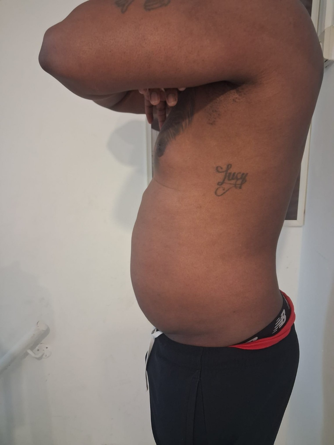 Body contouring treatment side profile image