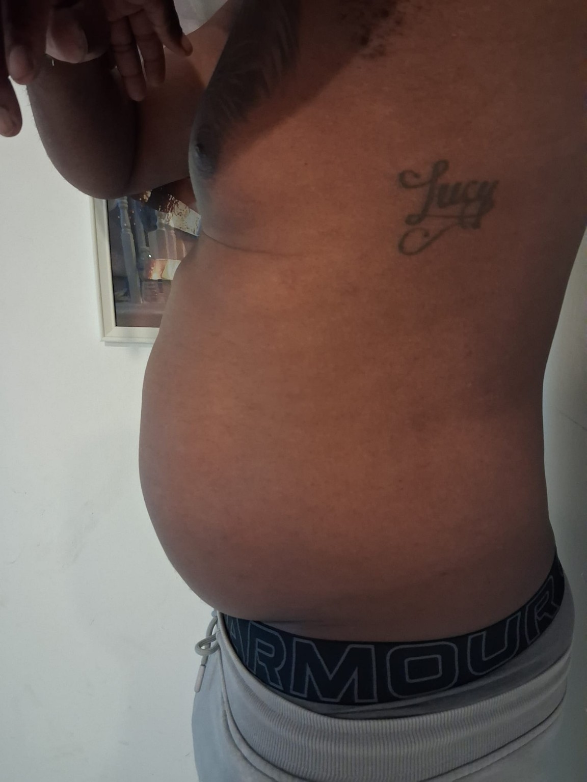 Body contouring progress side profile image