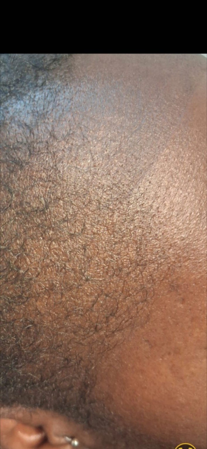 Hair restoration close-up image